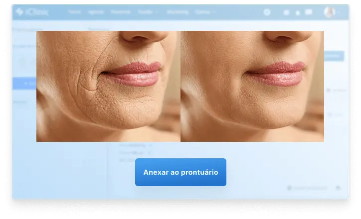 Comparação de imagens no prontuário do Afya iClinic — dados fictícios para demonstração