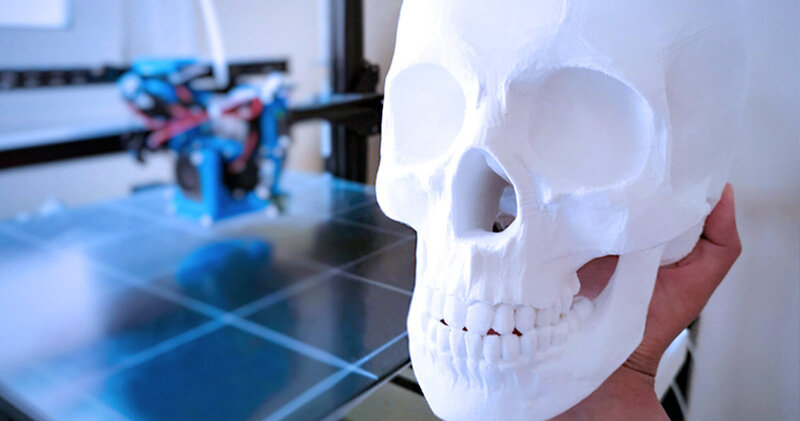 impressora 3d na medicina impressao de modelos