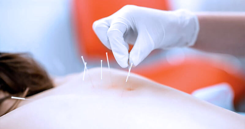 medicina integrativa tratamento com acupuntura
