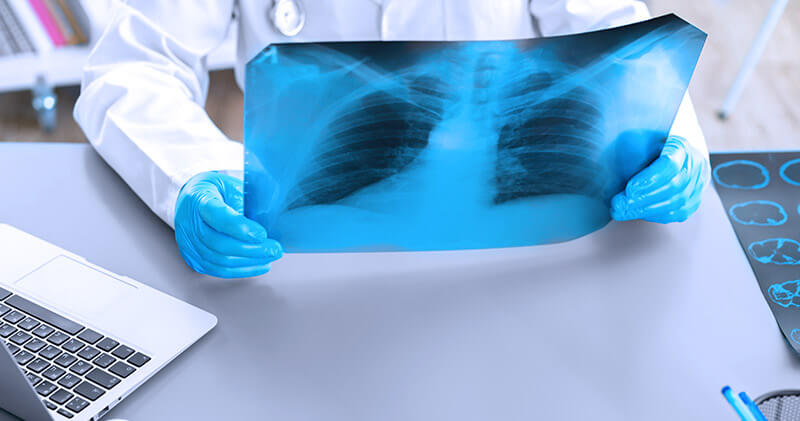 telerradiologia raio x do pulmao
