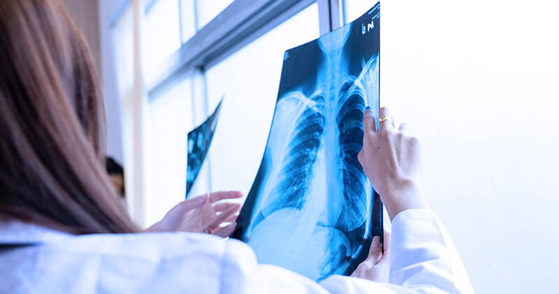 telerradiologia raio x pulmonar