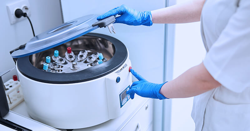 Quando é necessário solicitar o exame FAN para os pacientes? 4 exame fan equipamento