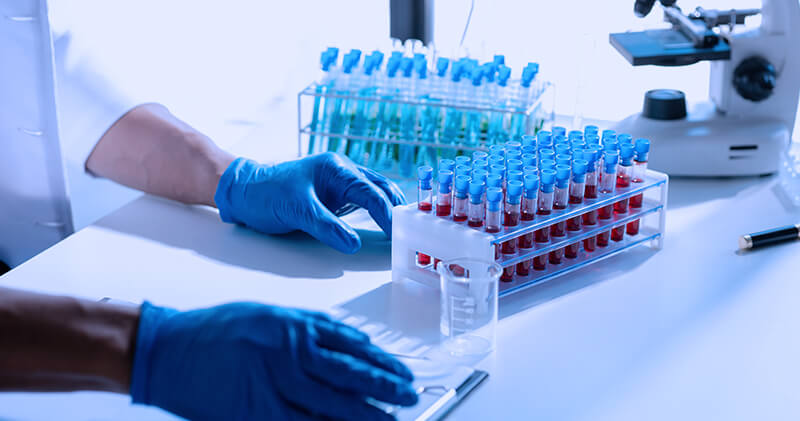 9 passos para implementar a Medicina preditiva no seu consultório 4 medicina preditiva laboratorio